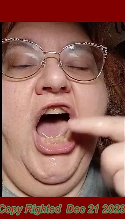 Requested Video Look Inside My Mouth