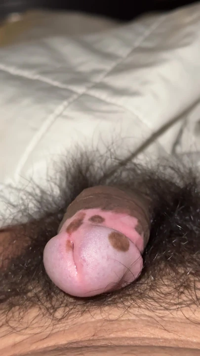 Masturbation