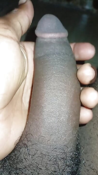 Sụt cu của tôi
