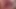 Small cervix without dilating