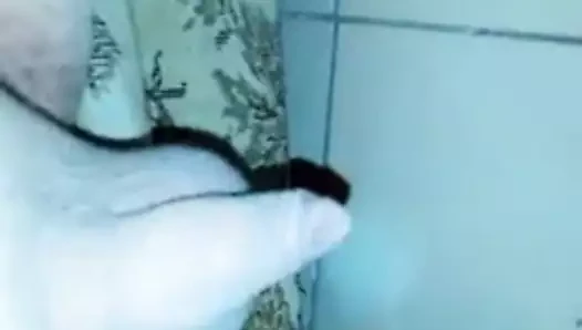 Sünnet derisi