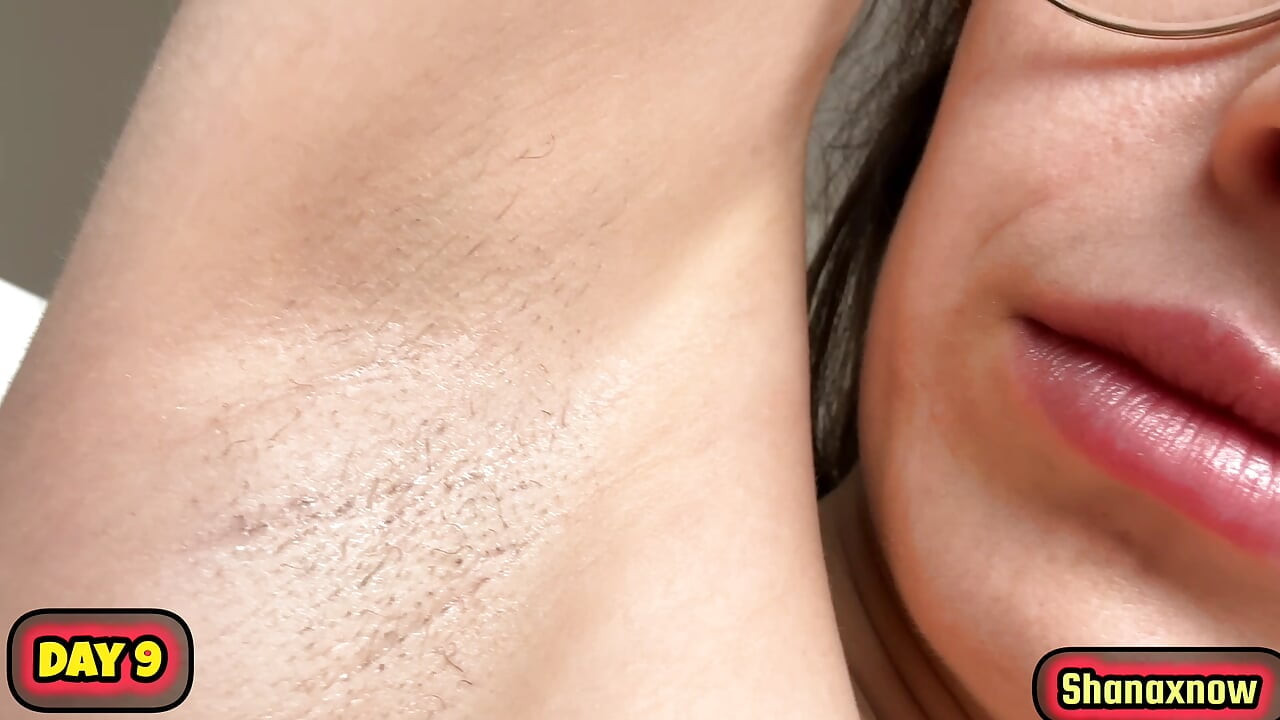 10 DAYS ARMPITS GROW HAIR EVOLUTION VIDEO