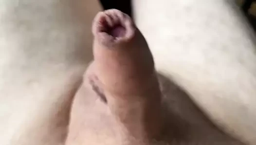 forskin oyun