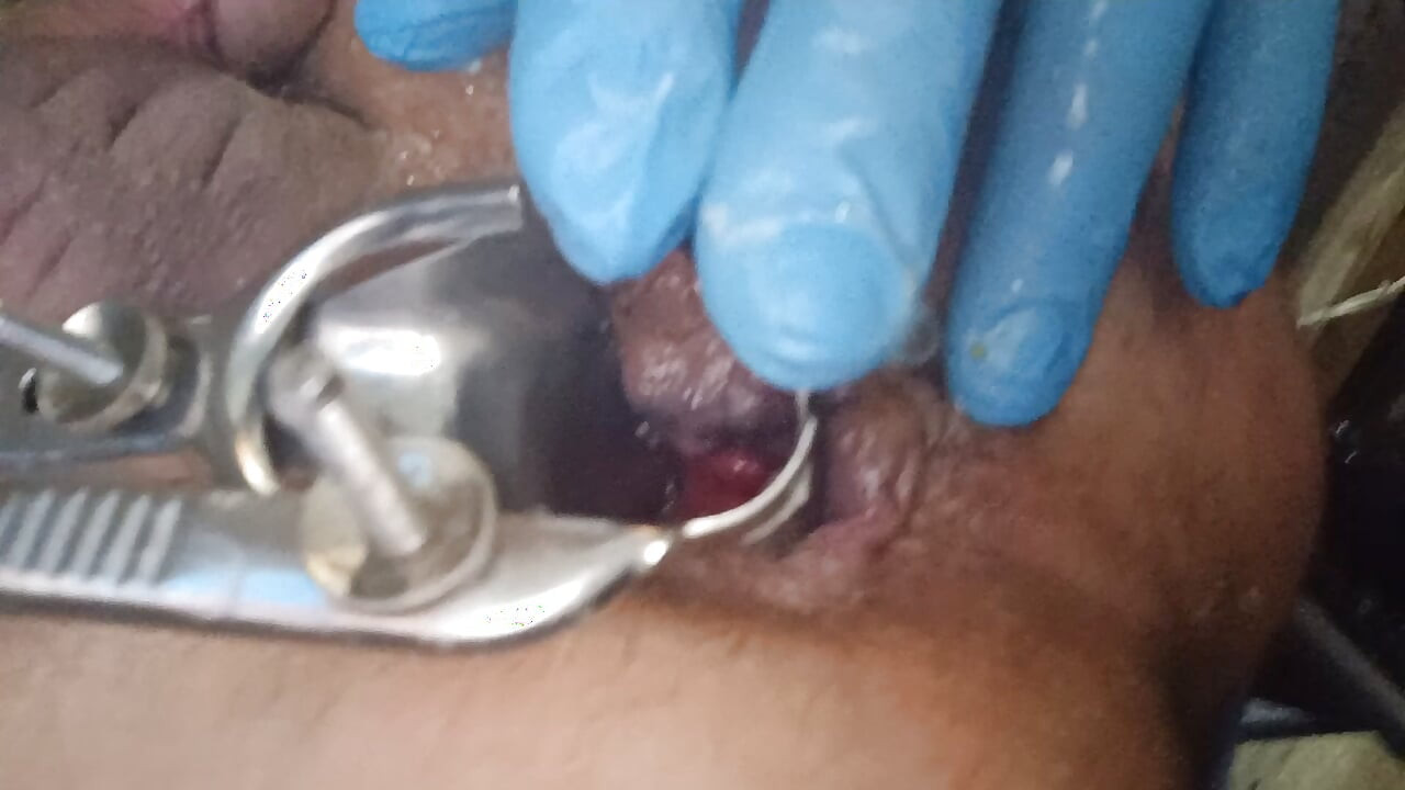 Entrenamiento del espéculo