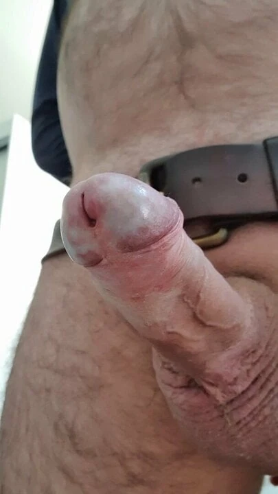 Prostate milking