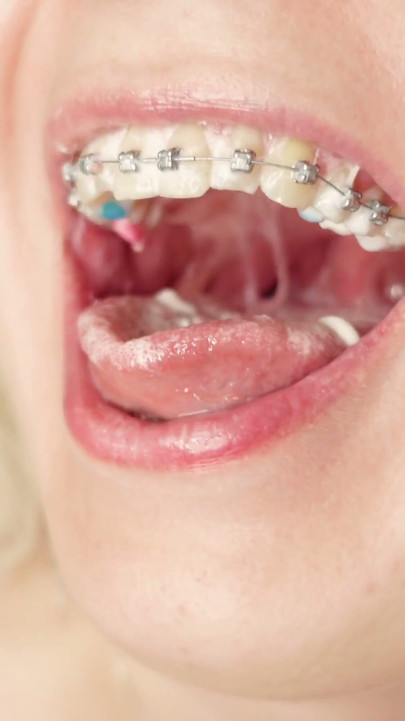 ASMR mukbang in braces - eating ice-cream | Clip 1