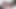 オタクの赤毛が痛む足に注意を払う