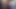 セラピーは自由に使われるクソゴミ箱で終わる