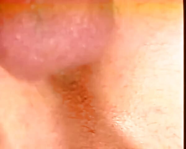 Eager Guy Flesh Harmony #2