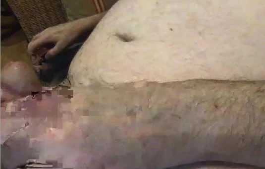 grandpa stroke on webcam