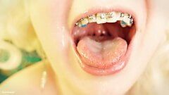 eating in braces - vore and food fetish - close up video