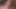 Self Face Slapping and Punching (custom Video)