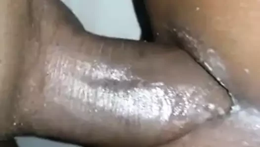 Anal