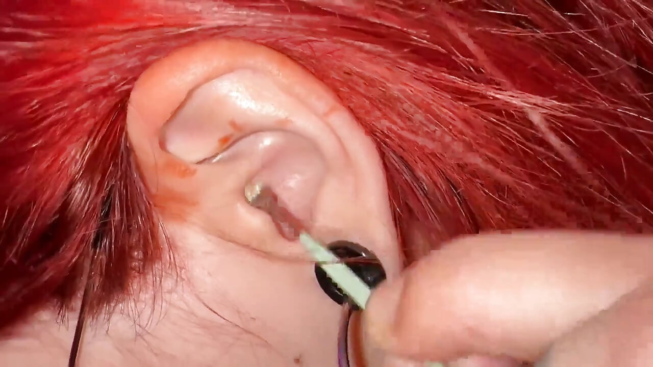 Cleaning Ear Wax