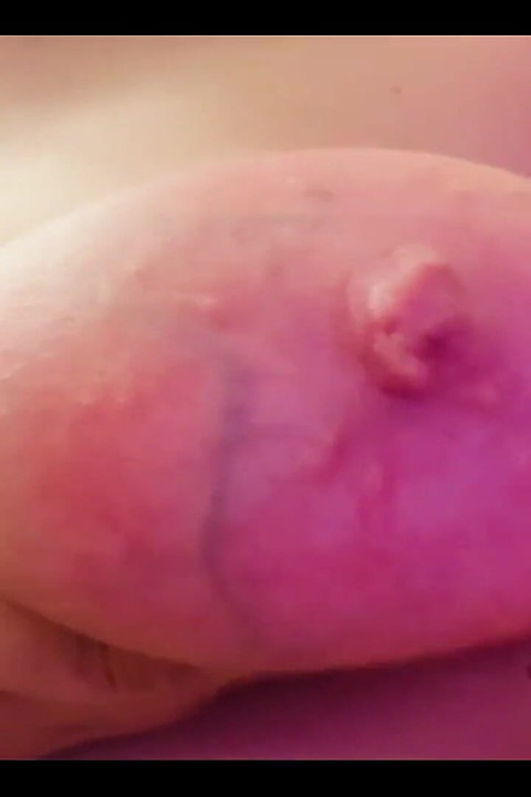 Goddamn I Think My Tits Grew Again??