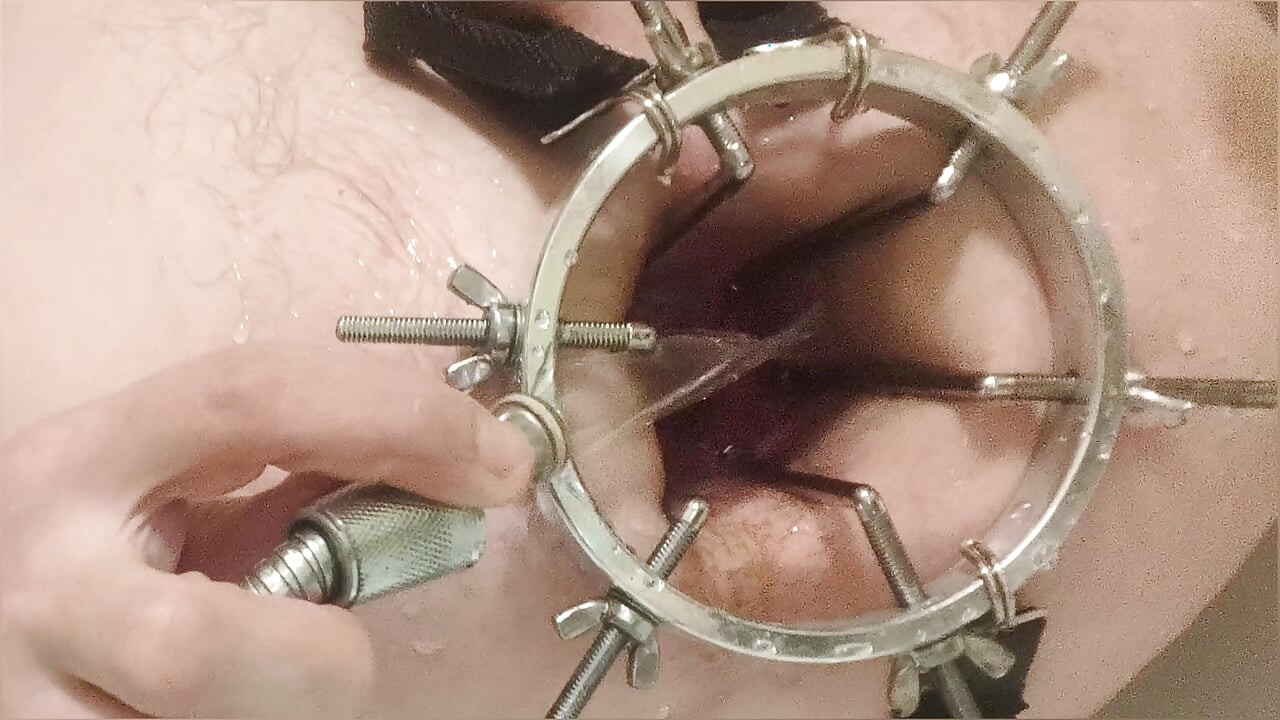 Enema, mandi dubur. Pandangan dekat melalui cermin dubur. Dubur dengan air. Mengisi dubur dengan air