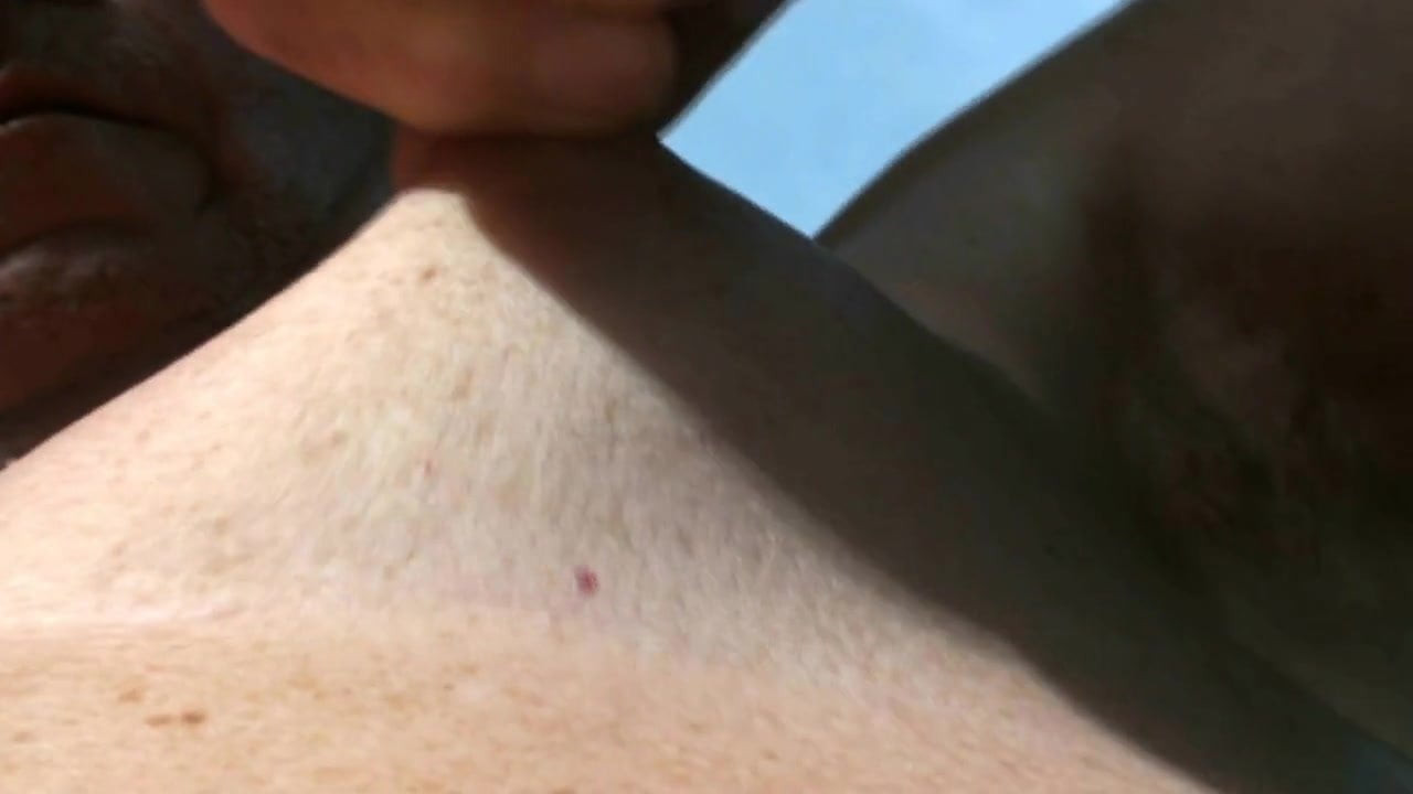 Nipple Pull