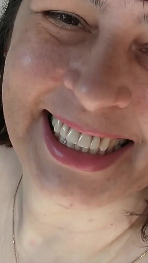 Hairy wife teasing husband taking a sunbathing naked | Clip 1