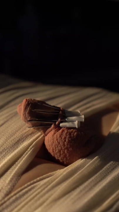 distracție medicală, mumificare, ac și și electro | Clip 1