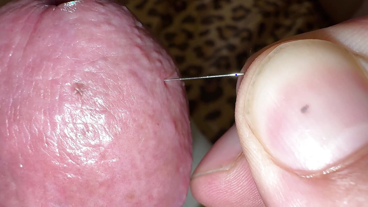 Needles through the hard glans!