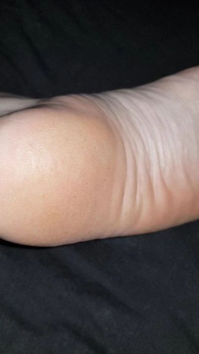 Wrinkled foot soles arches