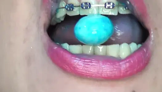 Ich Schlucke Ununterbrochen Große, Riesige Mandeln!!