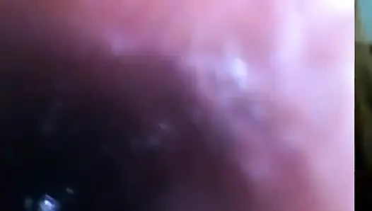 Endoskopi!! Giantess Menelan 25 Anggota Sekali lagi