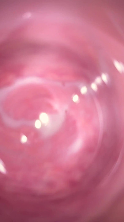 Câmera profundamente dentro da pequena vagina cremosa de Mia