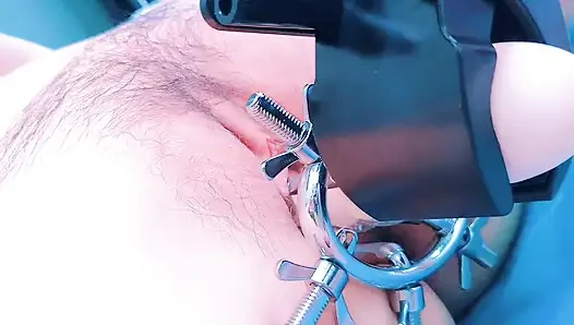 Speculum
