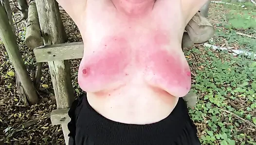 Red breasts with nipple braces