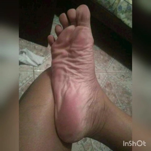 Pelmata