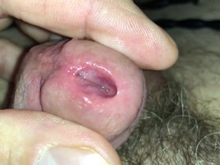 Pulling 2 urethra sounds out of my cock!!