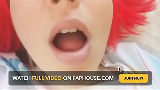 Chantal's Teeth Fall Apart, Rotten and Black