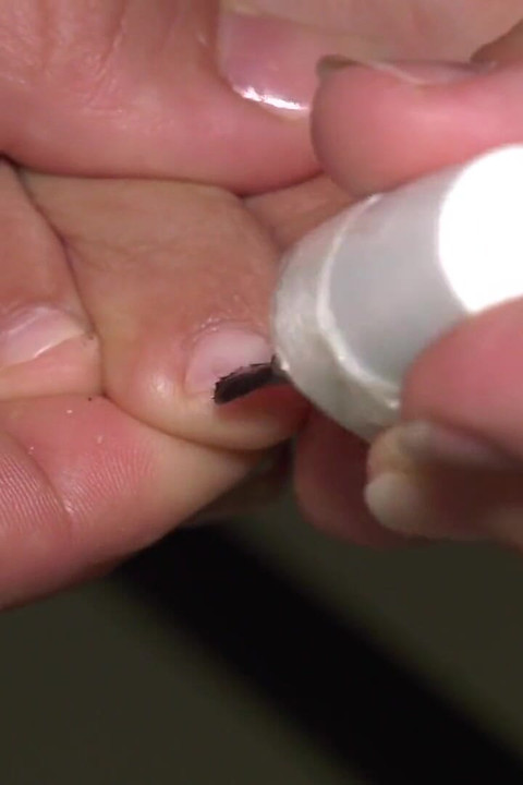 Βερνίκι νυχιών στα πόδια μου και ψίχουλα ποδιών ανάμεσα στα δάχτυλα των ποδιών μου