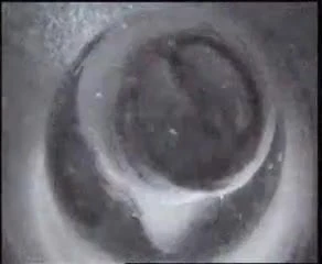 Sperm Cloud
