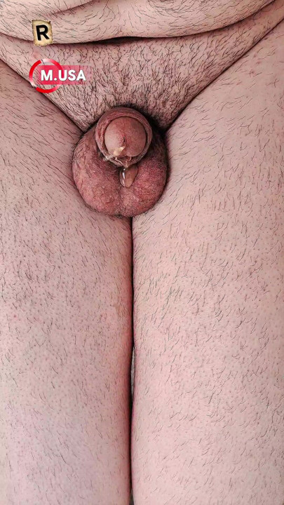 My wet penis is urinating."