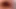 Fat pussy