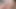 Masturbation Eichel Polieren aaaqqq
