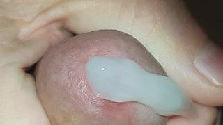 Sperma stroomt uit het geopende eikelgat