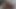 Lizzy Yum VR APRIL 2025 post op Solo Masturbation, dilate, bathing, orgasm, anal, sextoys, edging #2