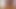 Knitting Needle Sounding and Cum