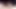 Micropenis in slow motion