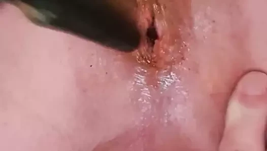 Anal2