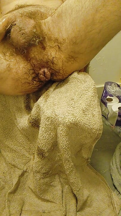Chorro de meo anal