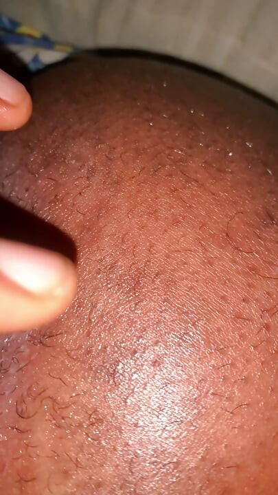 블랙 버시