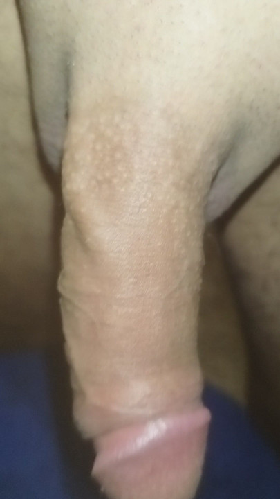 I rub it a little, maybe someone with a mouth, for example.
