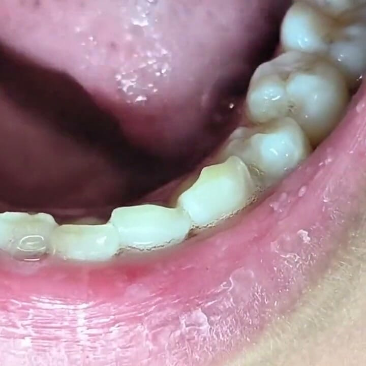 Gigante hace que un pequeño hombre nada en su saliva