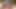 ربط ثلاثي مع Bimfcouple