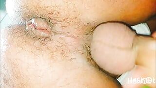 My hole is swollen and hot