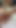 Ellili yaşlarında bol bir mazoşist, seks oyuncağını ona vidalıyor ve anal deliklere ulaşıyor, ardından oyuncak içinde sıkışmış anal sekste ölüyor